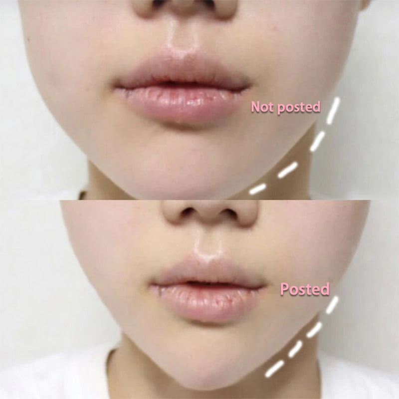 40-Piece Invisible V-Line Face Lift Tapes with Lifting Ropes for Women