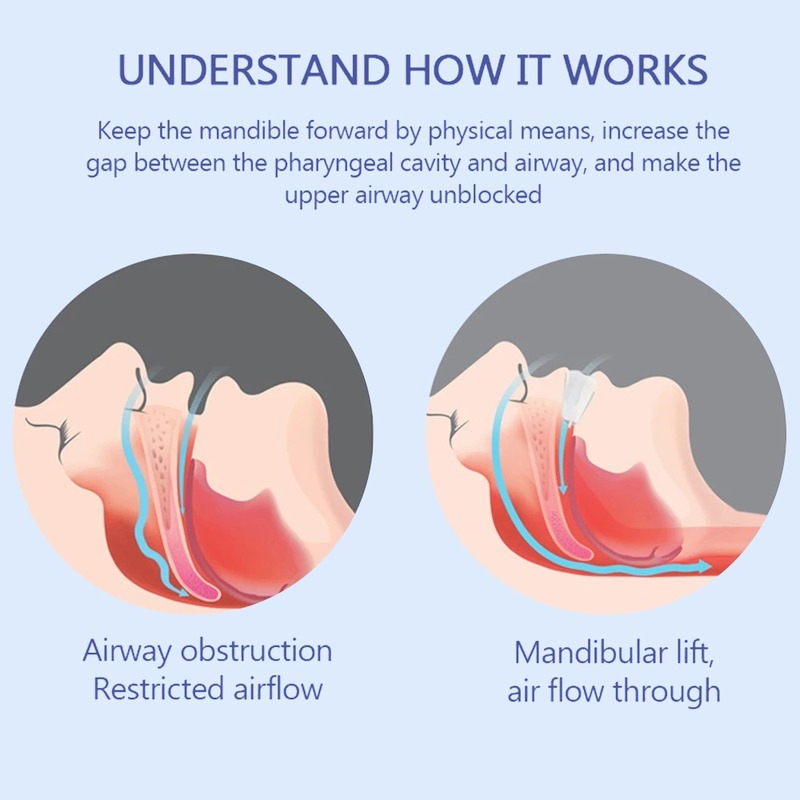 Anti-Snoring Mouthpiece | Helps Stop Snoring | The Original Anti-Snoring Solution | Comfortable & Adjustable